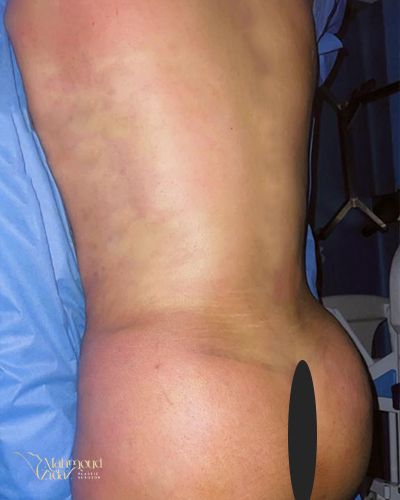 بعد العملية 1